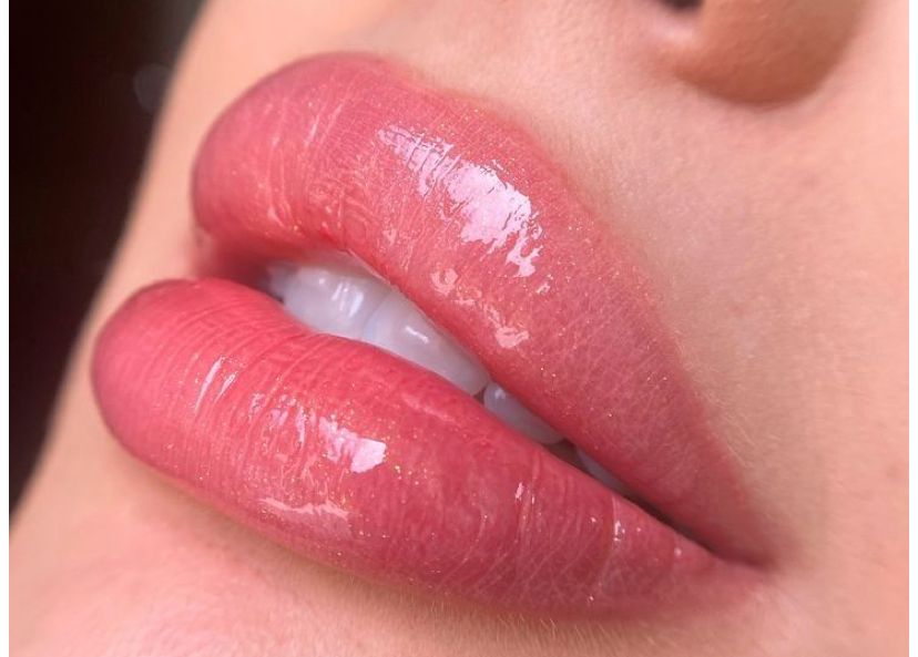 Preenchimento Labial