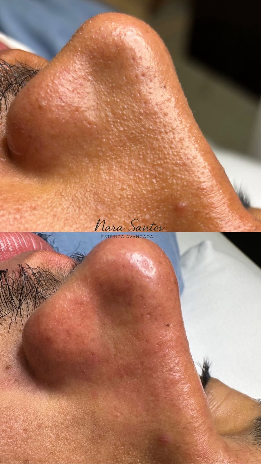 Limpeza de Pele Regeneradora